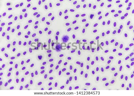 Malaria parasite under the microscope view.