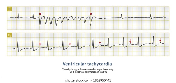 54,346 Syndrome Treatment Images, Stock Photos & Vectors | Shutterstock