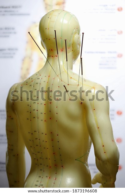male\
acupuncture model with needles in the right\
shoulder