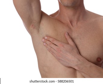 Male Armpit With Irritation After Shaving, Underarm Razor Burn