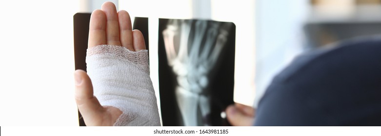 30 Squeezing arm bruises Images, Stock Photos & Vectors | Shutterstock