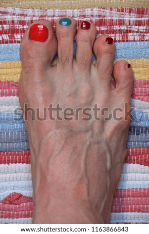 male barfoot feet painted with colored nail varnish