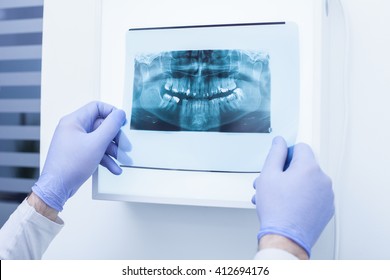 Male doctor holding and looking at dental x-ray