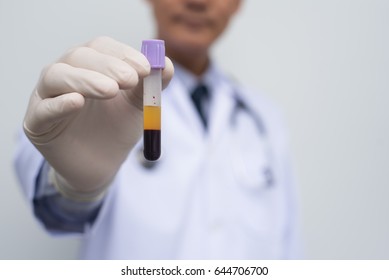 Male Doctor Or Technician Holding   Centrifuge Blood Or Blood Fractionation In Test Tube For The Sample. It Is Real Human Blood. Health And Medical, Blood Analyzing Concept.