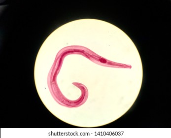 Male Enterobius Vermicularis Adult Stage In Light Microscope