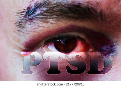  Male Face With  Bruise Suffering Post Traumatic Stress Disorder. PTSD Concept