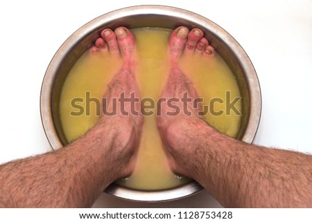 male feet in a basin with mustard soars his legs, on a white natural background
