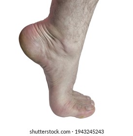 male foot, standing on tip toe, with the heel raised, isolated on white background