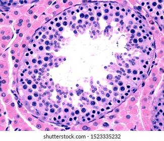 Male Germinal Epithelium Showing Spermatogonia, Spermatocytes In Meiosis (zygotene And Pachytene), Spermatids, And Spermatozoa With Elongated Nuclei. Leydig Cell Are Located Outside The Tubule.