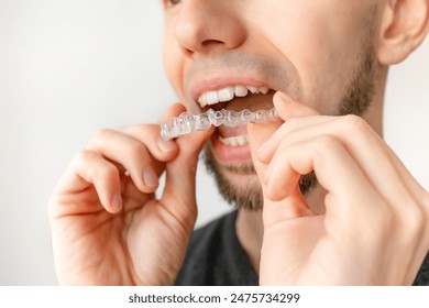 Male hand applying dental aligner retainer of dental clinic for beautiful teeth treatment. Orthodontic removable straighteners in dentist office - Powered by Shutterstock