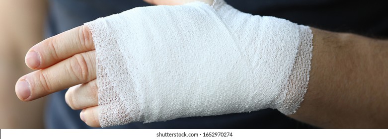 30 Squeezing arm bruises Images, Stock Photos & Vectors | Shutterstock