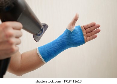 Male Hand Wrapped In Fiberglass Plaster Cast Dries With A Hairdryer. Broken Wrist In A Modern Waterproof Bandage