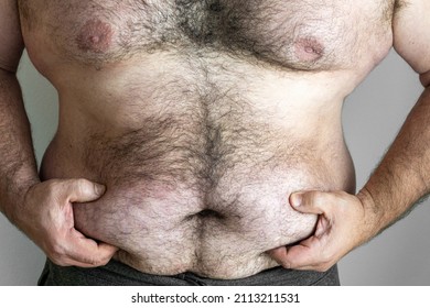 Male hands grasp the folds of the belly, on a hairy, obese male torso. Endomorph and obesity concept.