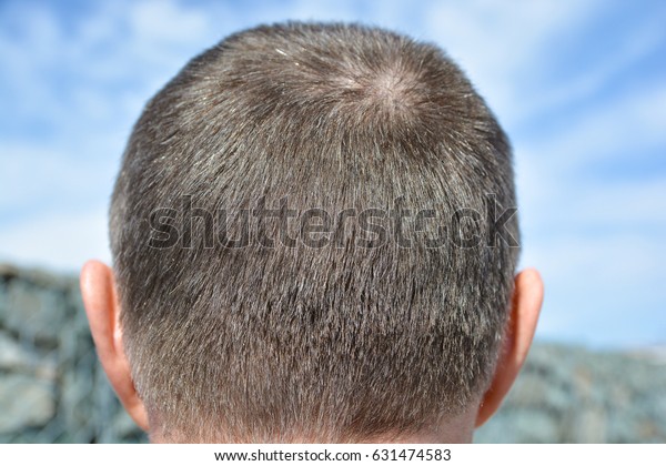 Male Head Short Hair On Back Stock Photo Edit Now 631474583