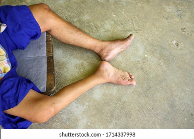 Male Legs That Are Small And Normal Legs Caused By Polio Cement Floor Background