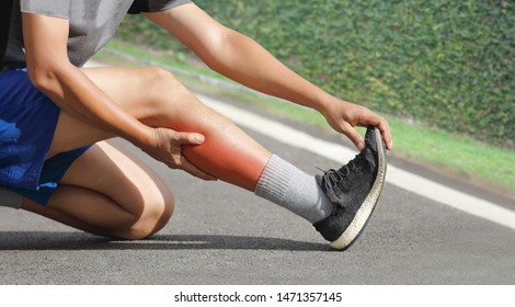 Male Middle Aged Having A Cramp While Jogging. Stop And Massage Calf