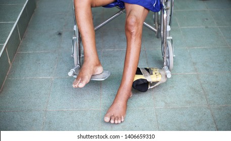 5,829 Broken leg wheelchair Images, Stock Photos & Vectors | Shutterstock