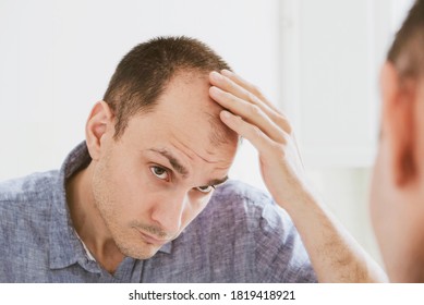 Male pattern hair loss problem concept. Young caucasian man looking at mirror worried about balding. Baldness, alopecia in males.
