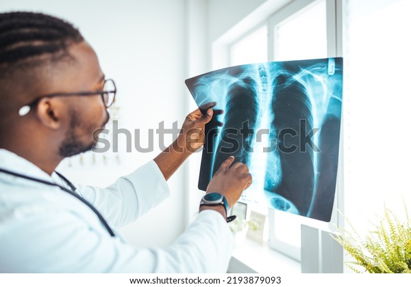 Male radiologist analyzing chest X-ray of an\
patient at medical clinic during coronavirus epidemic. Doctor with\
radiological chest x-ray film for medical diagnosis on patient\'s\
health on asthma