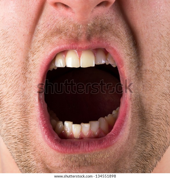 Male Screaming Open Mouth Teeth Stock Photo Edit Now