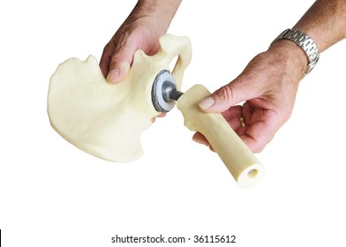 Male Surgeon Explaining Hip Replacement To Patient By Showing The Titanium Joint, Isolated On White Background