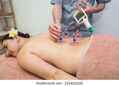 male therapist giving treatment with cupping on the back. The masseur puts cans on the back of a young girl