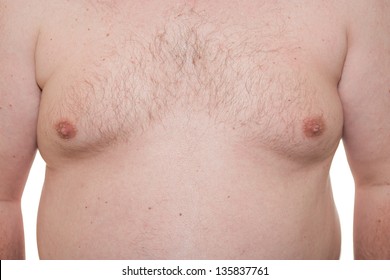 Male thorax showing early stage Gynecomastia or man boobs also a symptom of obesity