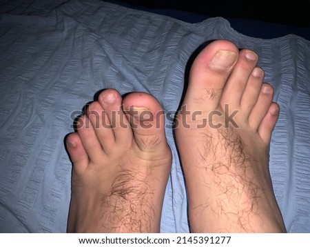 Male who enjoy to showing his feet! Feet fetish