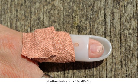 Mallet Finger Splint