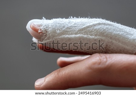 Mallet finger, stack splint on the middle finger with bandage to immobilize the last phalanx following joint trauma