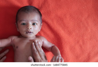 Malnourished Baby Looking At The Camera Lying On Orange Red Velvet Cloth Background. Protein Energy Malnutrition Concept Image