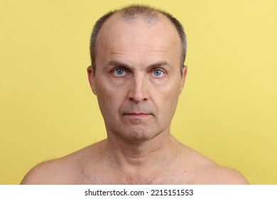 A Man 45-55 Years Old Without Clothes With A Hairy Chest On A Yellow Background.