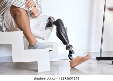 Man amputee with prosthetic leg disability on above knee transfemoral leg prosthesis artificial device sitting on stairs, close up. People with amputation disabilities everyday life.