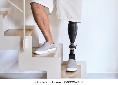 Man amputee with prosthetic leg disability on above knee transfemoral leg prosthesis artificial device stands on feet on stairs, close up. People with amputation disabilities everyday life. - Powered by Shutterstock