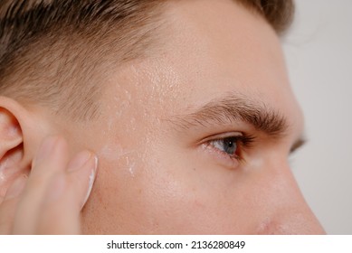 Man Applying Acne Cream On Face.Young Man Applying Cream For Problem Skin On Face, Closeup