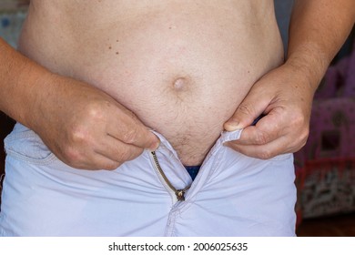 A Man With A Big Belly Is Obese, His Pants Are Too Small Because Of A Big Fat Belly