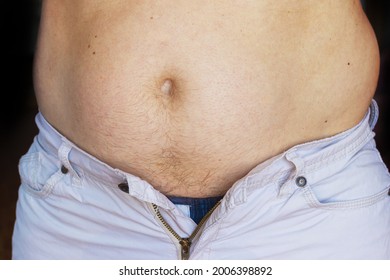 A Man With A Big Belly Is Obese, His Pants Are Too Small Because Of A Big Fat Belly