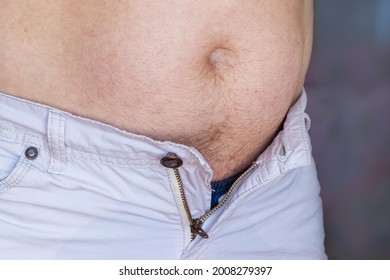 A Man With A Big Belly Is Obese, His Pants Are Too Small Because Of A Big Fat Belly