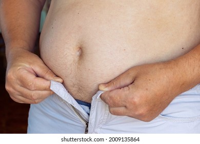 A Man With A Big Belly Is Obese, His Pants Are Too Small Because Of A Big Fat Belly