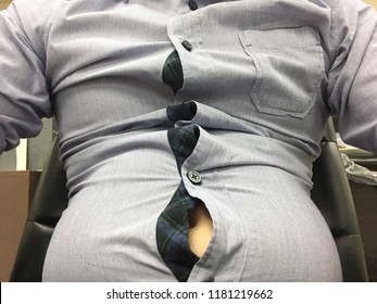 Man With Big And Fat Belly Wearing Too Small And Tight Shirt Sitting On The Chair. Need Exercise For Body Fit. Healthcare And Diet Concept