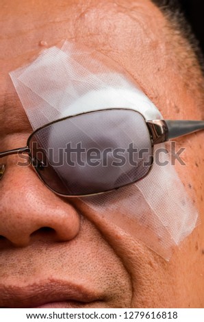 Man blindfolded with eye pad because eye inflammation.