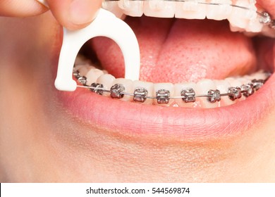 Man With Braces Using Dental Floss For Hygiene