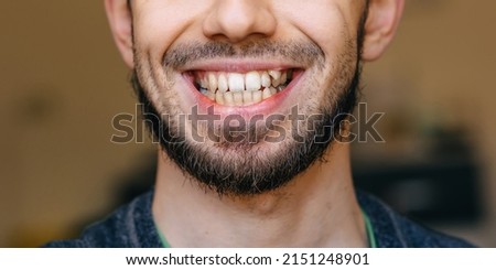 A man with bristles and an open mouth with uneven teeth