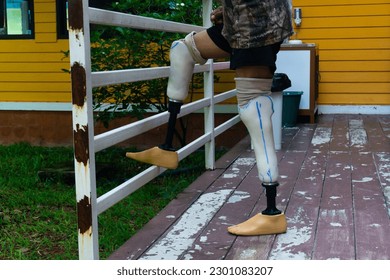 A man with a broken leg is standing on the balcony. - Powered by Shutterstock