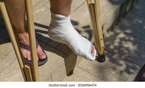 2036906474. Mann mit gebrochenem Bein aus weißem Gips, der mit Krücken die Treppe...