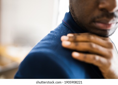 Man Brushing Dandruff From Dirty Suit. Itchy Head And Hair