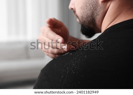 Man brushing dandruff off his sweater indoors, closeup. Space for text Foto stock © 
