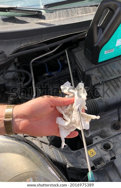 a man\
checking the engine oil level of his\
car