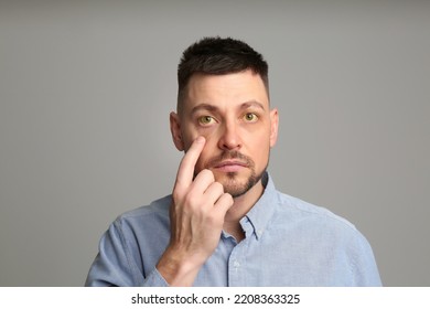 Man checking his health condition on grey background. Yellow eyes as symptom of problems with liver - Shutterstock ID 2208363325