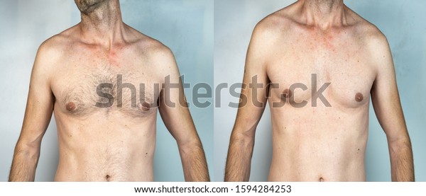 man with chest hair and shaved man in the same\
image, isolated on White\
background